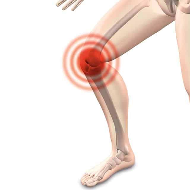 Comment savoir si j'ai de l'arthrose au genou ?, Dr Paillard